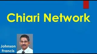 Chiari Network in Right Atrium