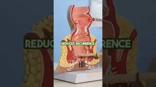 Benefits of Ayurveda for Pilonidal Sinus