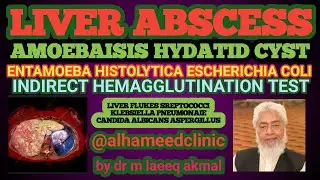 PYOGENIC,AMOEBIC,FUNGAL LIVER ABSCESS TRANSMIT FROM INTESTINES,OR BILIARY CHANNELS ETC.HYDATID CYST 