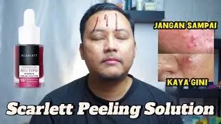 REVIEW + CARA PAKAI SCARLETT INTENSIVE PEELING SOLUTION