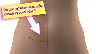 Cirugia estética, Cesárea horizontal / porque se realiza la cesárea acostada o parada