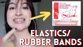 Braces: ELASTICS // RUBBER BANDS *My experience + tips