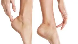 Gehwol Med Callus Cream 30s