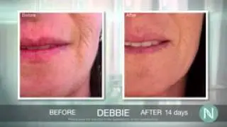 Nerium Results Great Real Results Using Nerium
