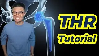 See How Doctors Fix a Bad Hip Step by Step!