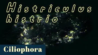 Histriculus histrio (Ciliate or Ciliophora)