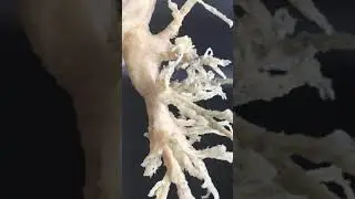 Plastinated  Lung Model   Right Bronchial Tree exposed