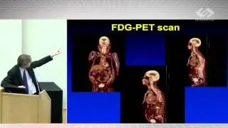 J. Bax. Infective endocarditis. Case presentation
