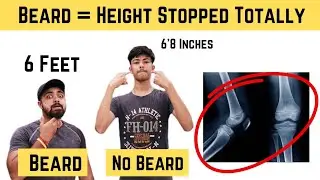 Beard Stops Growth Plates To Increase Bones Length After Age 15 ! Can You Increase Height