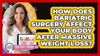 How Does Bariatric Surgery Affect Your Body After Massive Weight Loss?