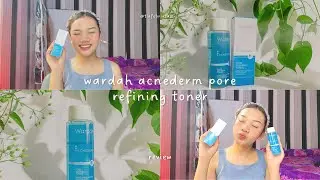 my honest review : wardah acnederm pore refining toner ✨