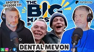 Spotify Ep 171 - Dental Mevon