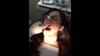 DH200 Intra Oral Exam #4 Hard Palate