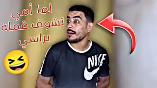 لما أمي تشوف قشرة براسي 🤣 : قمل😱