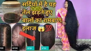 सर्दियों में इस तेल से गंजे सर पर भी उग आएंगे नए बाल 💯#hair #@m.r.dhairgrowthvlogsuttrakhand 