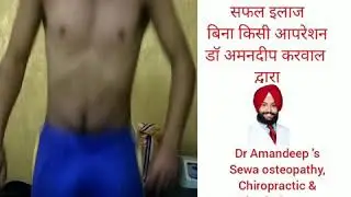 Osteopathy, choropractic & physiotherapy by dr Amandeep karwal in India 9772033322 # disc pain