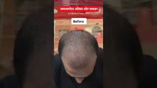 jamalgota for hair regrowth #jamalgota #crotontiglium #jayapala #jamalgotaseeds #jamalgotaforhair