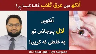 Eye Redness Ka Ilaj | Red Eyes Causes | Red Eye Infection Treatment | Aankhon Ka Laal Ho Jana