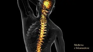 Mal di Schiena di tipo infiammatorio: riconoscere i segnali per gestirlo con i nuovi farmaci