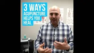 Best Acupuncture Etobicoke Malton Rexdale