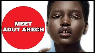 ADUT AKECH: FROM REFUGEE CAMP TO INTERNATIONAL RUNWAY #MODELOFTHEYEAR #SUPERMODEL #BLESSINGNJOH