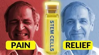 From Injury to Pickleball: How Stem Cells Fixed My Shoulder