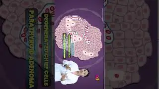 Parathyroid Gland Part - 2 #shorts