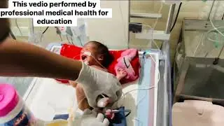 Cute Baby Diaper Changing & Gentle Care in NICU 💞 | Heart-Touching Moments #NICUBaby #babycare 