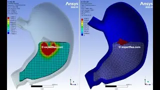 Simple FEA Simulation of the Digestive Bolus Entering the Stomach - ANSYS WB Explicit Dynamics