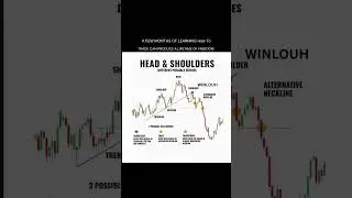 candle stick pattern part 18 #trading #treader #forex #shortvideo #treader #shortsvideo #trades