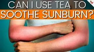 Can I Use Tea to Soothe Sunburn? | How Effective Is Tea for Sunburn?