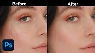 Skin retouching in photoshop
