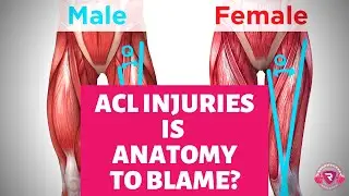 ACL Injuries:  Is Female Anatomy to Blame ?