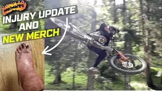 INJURY UPDATE AND MERCH DROP