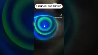 #ortho_k_lenses✌️ #specialitycontactlenses☝️#eyecareprofessionals