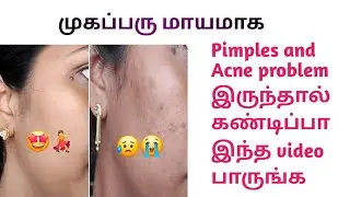 How to reduce Pimples and Acne marks