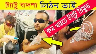ট্যাটু রিমুভ/Laser Tattoo Removal Works Bangladesh 2025😍  BD Tattoo Remove Center Bangladesh 2025