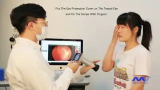 handheld fundus camera