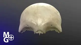Osul FRONTAL 3D (Curs de Anatomie)