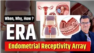 Endometrial Receptivity Array (ERA) Explained |Timing Embryo Transfer for Higher IVF Success