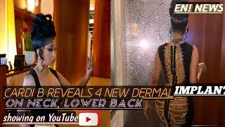 Cardi B Reveals 4 New Dermal Implants on Neck, Lower Back