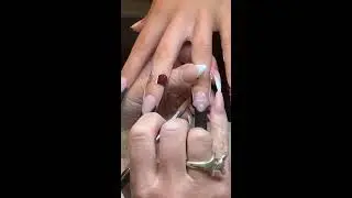 EDKO NAIL SYSTEMS