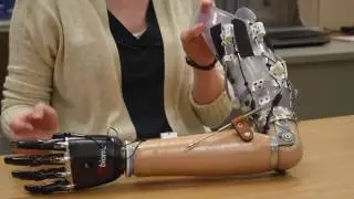 Using new technology to help amputees reconnect with the world