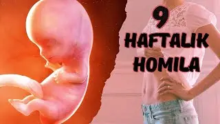 9 HAFTALIK (3 OYLIK) HOMILA RIVOJLANISHI.