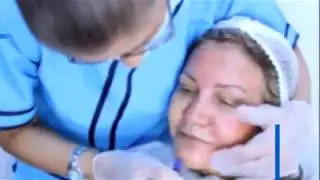 Collagen Therapy / Tratamiento para rejuvenecer la piel / Eliminar manchas