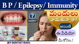 బీపీ/మూర్ఛవ్యాధి & ఇమ్యూనిటీ మందుల వల్ల కలిగే Side Effects ఏంటి? | Gum Specialist | Dr.K. RaviChandu