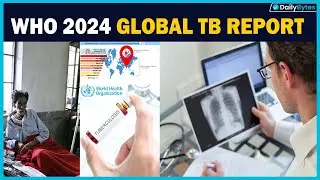 WHO 2024 Global TB Report Rising Cases, India's Progress, and the Fight to Eliminate TB #dailybytes