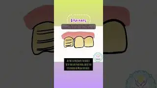 Dental Veneers #dentistry #dental #teeth #art #odontology #aesthetic #smilemakeover #dentalanatomy