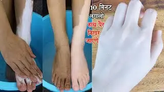 Colgate में बस यह चीज मिलाकर लगाओ काले हाथ पैर 10 Min में गोरे चमकने लगेंगे | Get Fair Hand & Feet