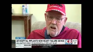 NEA Baptist first in state to implant CCM device for heart failure